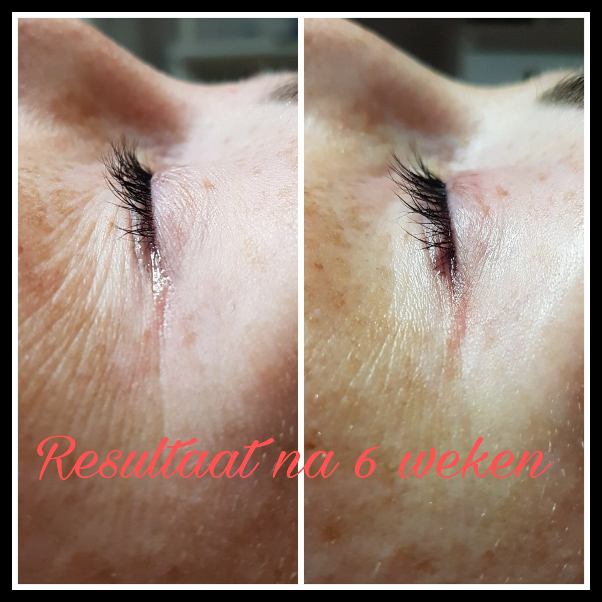 L'Biotica Active Lash voor en na 6 weken