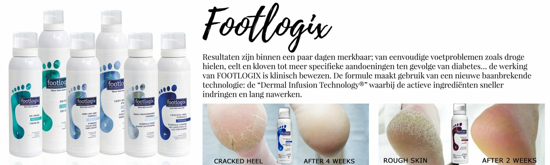 Footlogix Cracked Heel & Rough Skin Before after