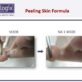 Footlogix Peeling Skin Formula voor na