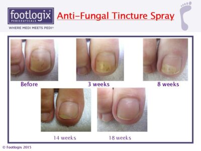 Footlogix Toe Nail Tincture 50 ml